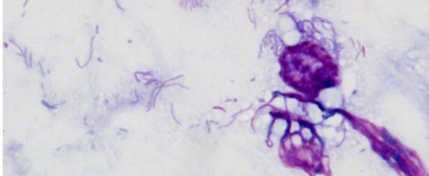 Cell-free polymorphic rickettsiae. Visualized by the Diff-Quik staining method.