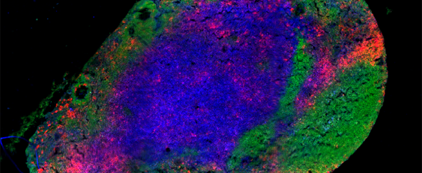 A549 airway epithelial cells grown in tissue culture.