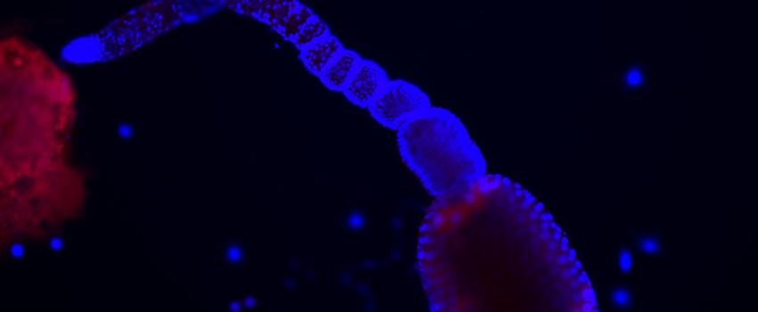 Dissected cat flea ovary. Specimen stained blue (Nuclei) and red (flea tissue). Visualized using fluorescence microscopy.