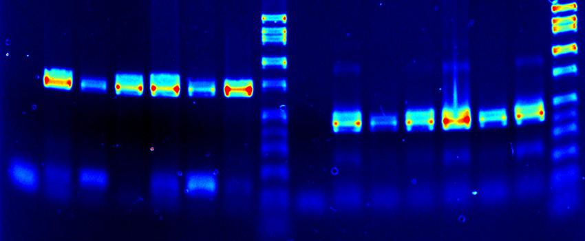 Spectrum enhanced (false colored) agarose gel DNA picture.