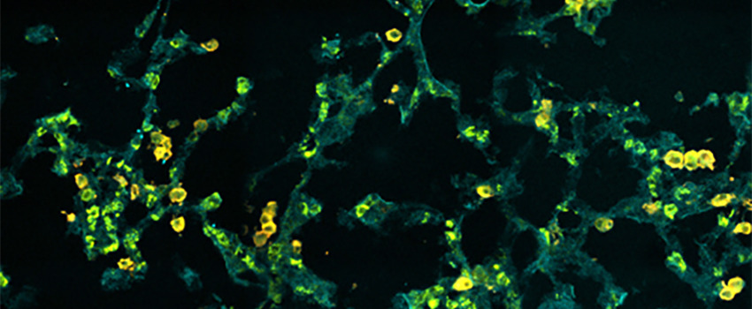 Immunostaining of the alveolar space within cryopreserved mouse lungs.  Image captured by confocal hyperspectral microscopy.