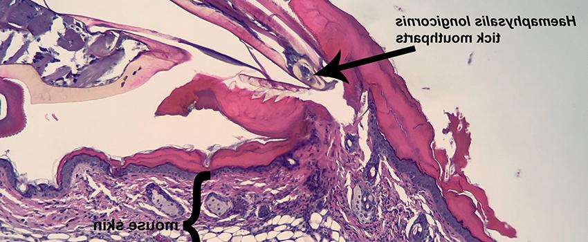 Histopathology of Haemaphysalis longicornis tick (i.e. Asian longhorned tick) feeding site.